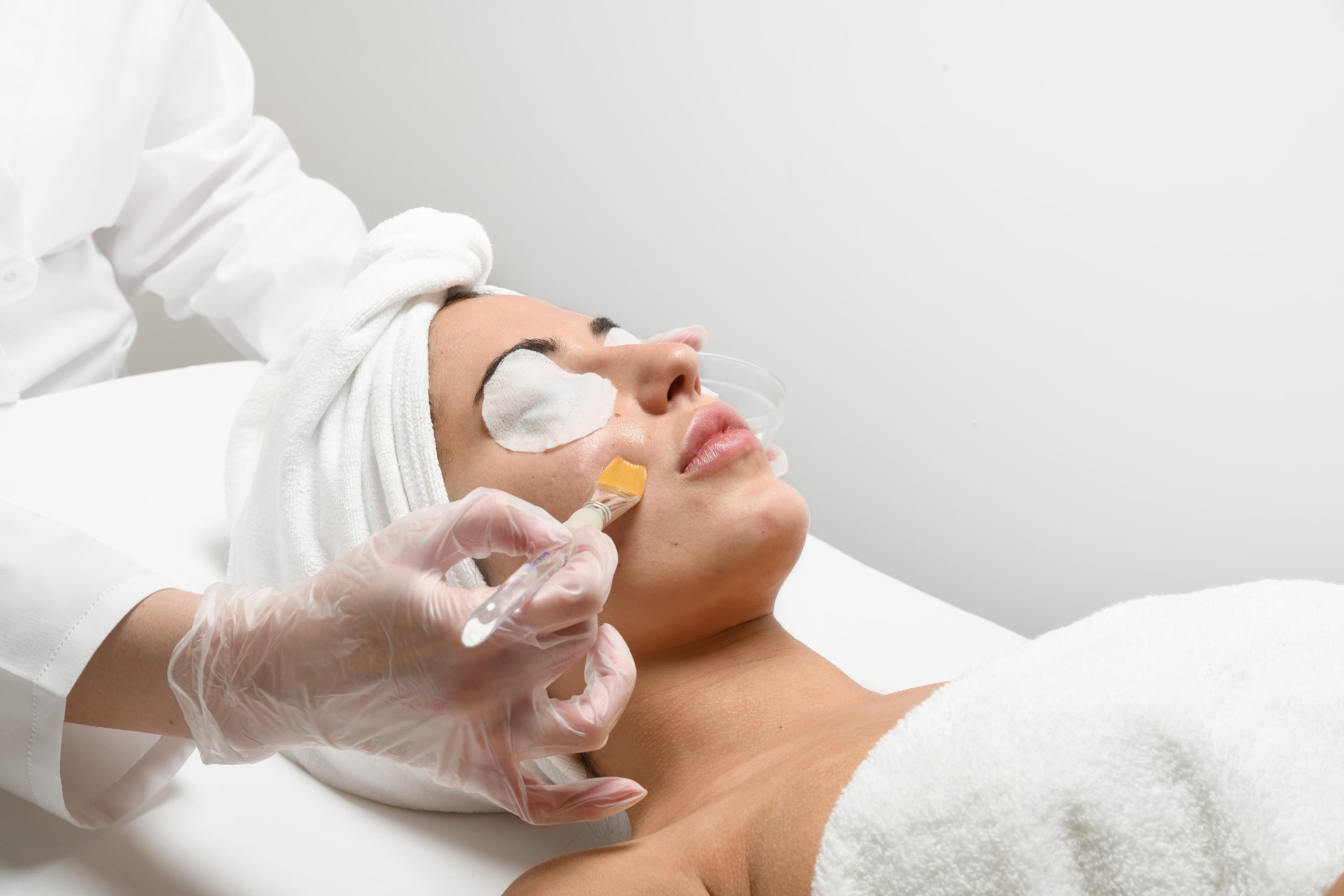 Marini glycolic resurfacing peel applied during treatment